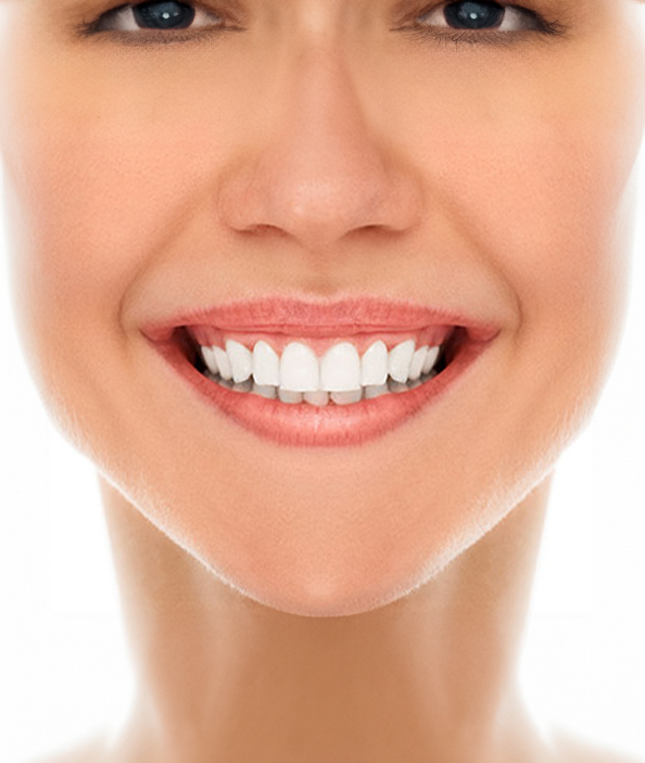 Diş Beyazlatma Tedavisi Nasıl ve Hangi Aralıklarla Yapılır?