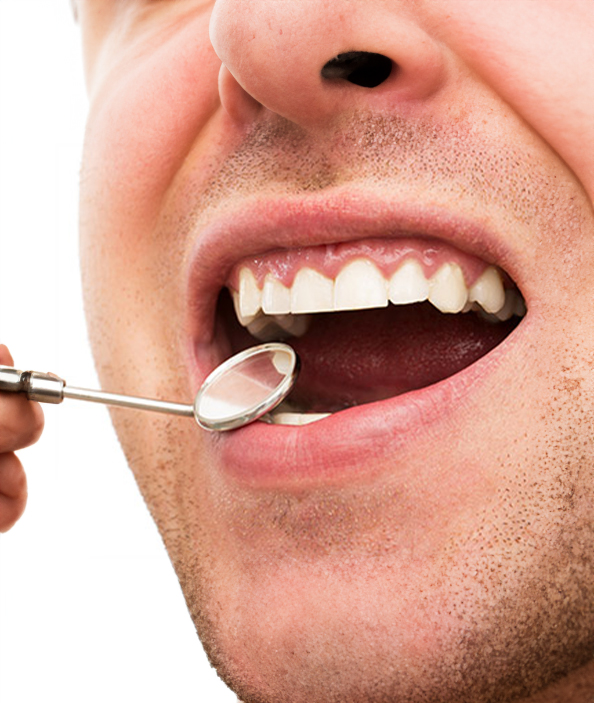 Diş Eti Hastalıklarının Nedenleri, Belirtileri ve Tedavisi