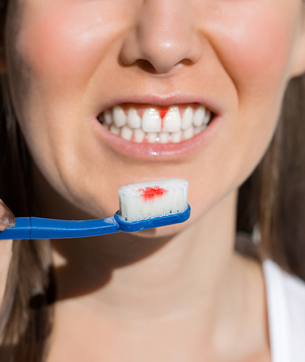 Diş Eti Kanamalarına Dikkat! Gizli Seyreden Hastalıkların Belirtisi Olabilir